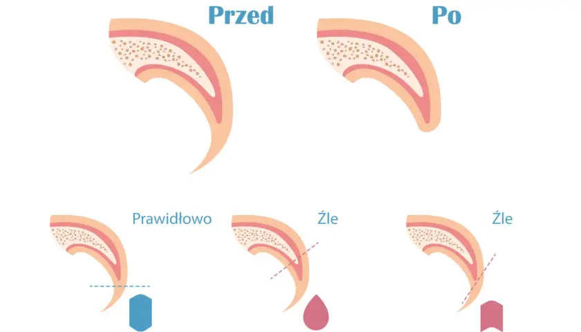 Ilustracja pokazuje przekrój psiego pazura przed i po obcięciu, a także prawidłowe i nieprawidłowe przycinanie. Dowiedz się, ile kosztuje obcięcie pazurów u psa.